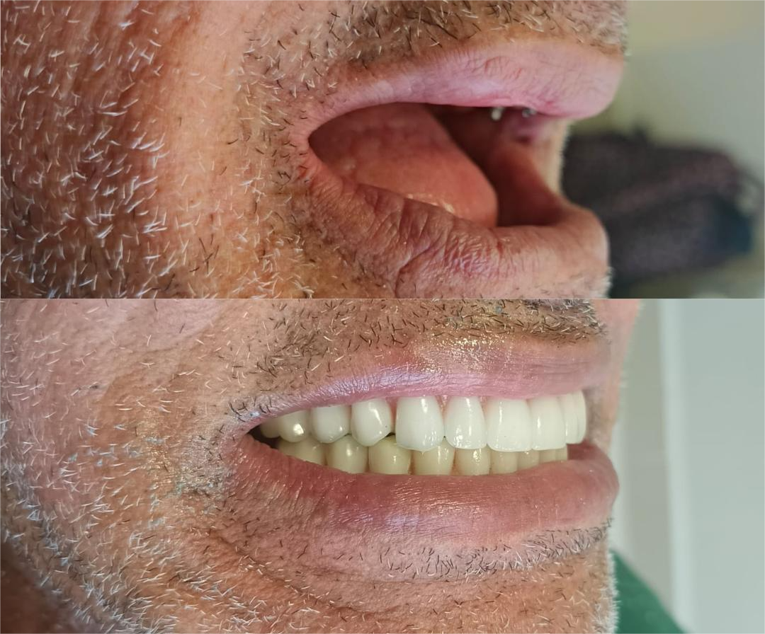 Sorriso após o tratamento